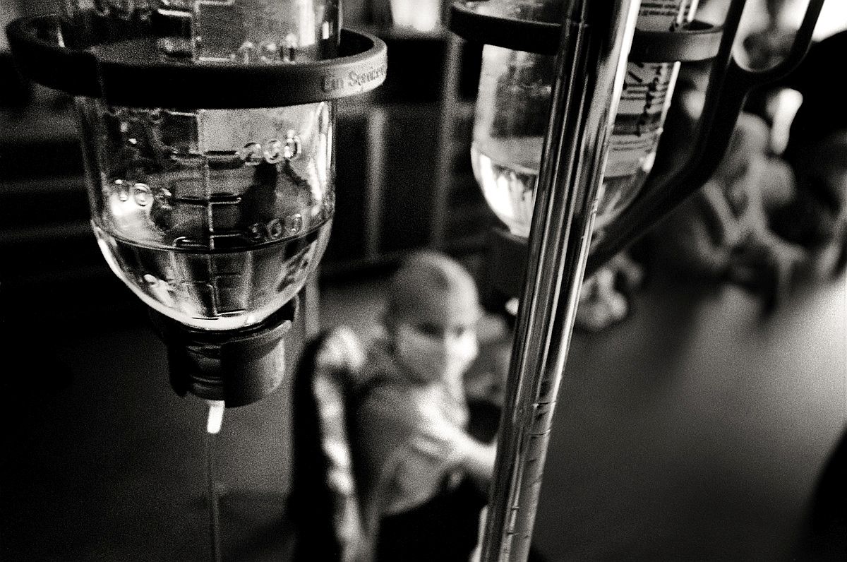 a child is undergoing chemotherapy in the treatment of 'hospital in Kiev The most terrible technological accident of human history knows: Chernobyl, once an unknown place in the rich land of the Ukraine. Now a single chilling word that still casts a dark shadow of death and contamination. Twenty years after the disaster that struck Europe, the tragedy continues. Many people live in villages close to the nuclear plant in conditions at the edge of human survival. The damage is still very much in evidence. Everywhere, in this area called THE ZONE, there is the burdensome heritage of disaster and everything still remain in total silence. The Chernobyl accident generated unknown victims by effects, it is impossible to know how many people dead for the consequences. The issue of long-term effects of Chernobyl disaster on civilians is controversial. Over 300,000 people were resettled because of the accident; millions lived and continue to live in the contaminated area. On the other hand, most of those affected received relatively low doses of radiation, there is little evidence of increased mortality – cancers or birth defects among them – and, when such evidence is present, existence of a causal link to radioactive contamination is uncertain.